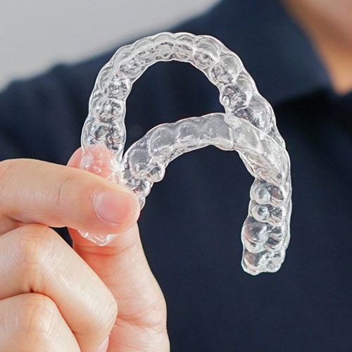 Clear aligners Yu Smiles Orthodontics in Gaithersburg, MD